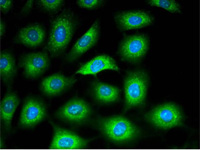 （ibidi） μ-Dish 35 mm培養(yǎng)皿-81156 81151 80136 80131 81158